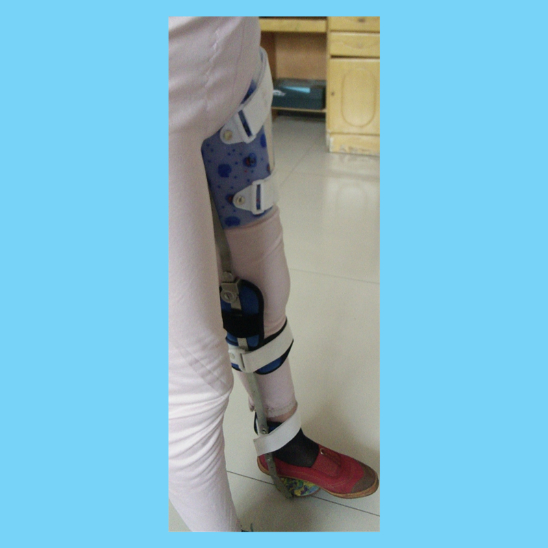 大腿免荷支具