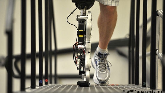 假肢的安装选择